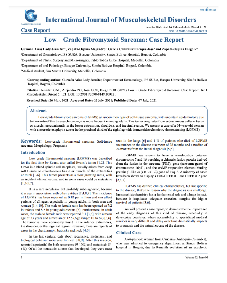 Low – Grade Fibromyxoid Sarcoma