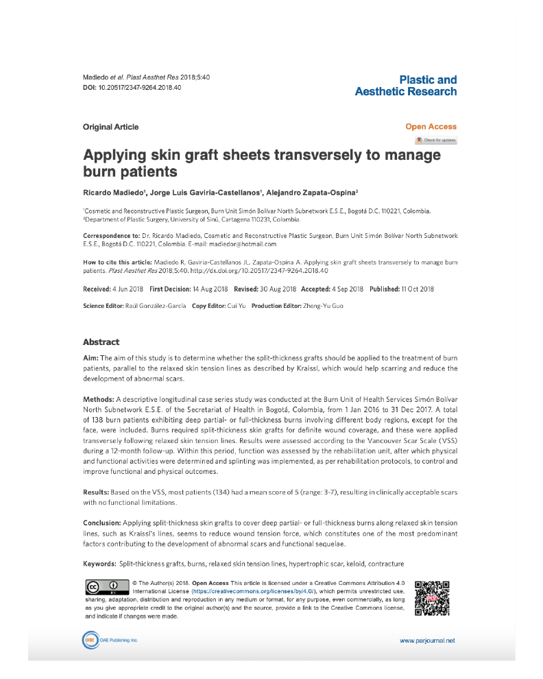 Applying skin graft sheets transversely to manage burn patients