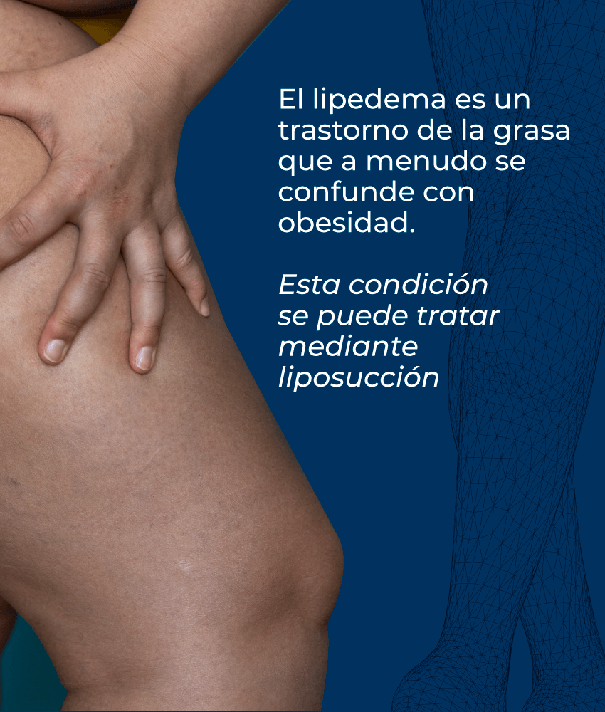 Cirujano Plastico Alejandro Zapata Linfedema Mesa De Trabajo 1 Copia 15