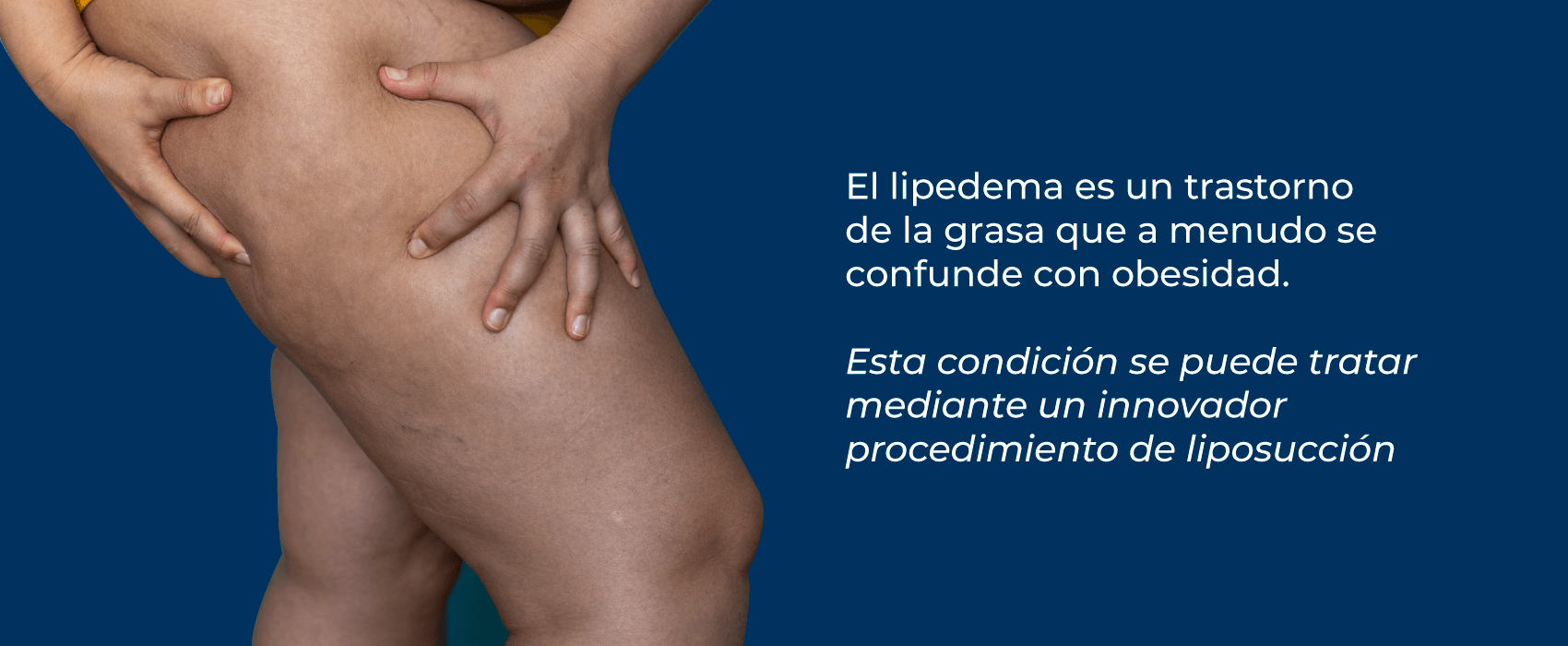 Cirujano Plástico Medellín | Cirugía de lipedema