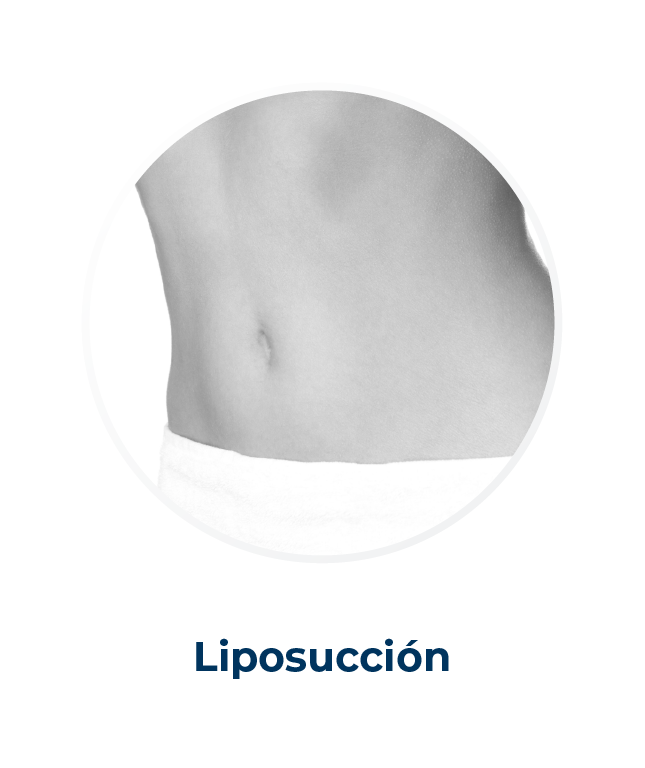 Cirujano Plastico Alejandro Zapata Linfedema Lipedema 15