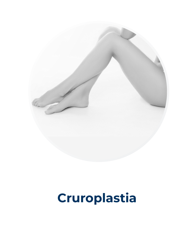 Cirujano Plastico Alejandro Zapata Linfedema Lipedema 17