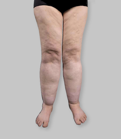 Etapa 1