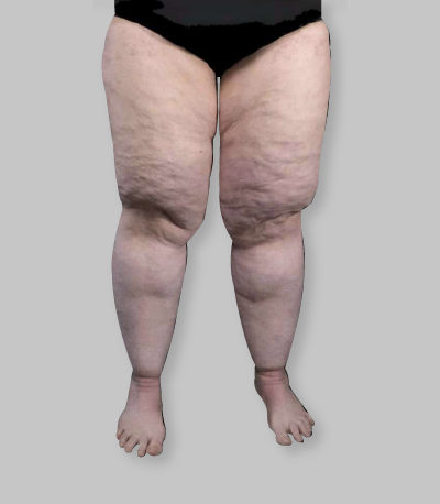 Etapa 2