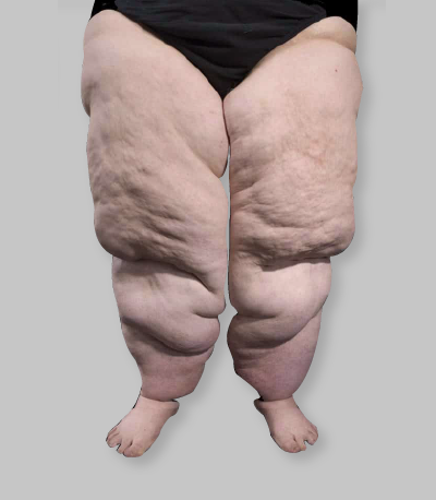 Etapa 3