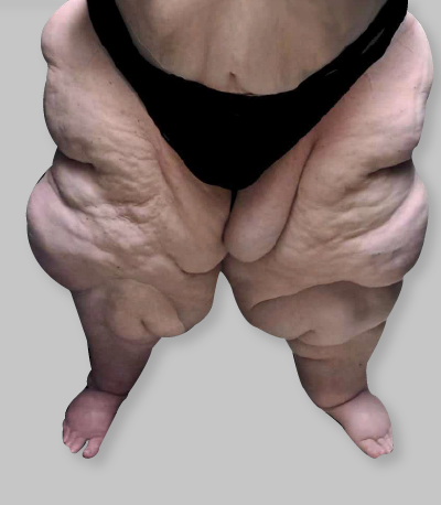 Etapa 4